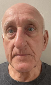 Allan Edward Patrick a registered Sex Offender of Vermont