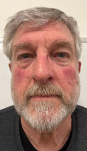 Joseph Shapow Weintraub a registered Sex Offender of Vermont