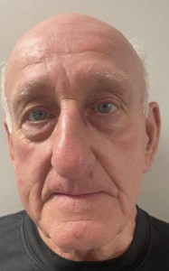 Allan Edward Patrick a registered Sex Offender of Vermont
