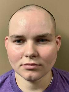 Michael Aaron Balser a registered Sex Offender of Tennessee