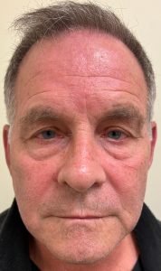 Joseph Annonio a registered Sex Offender of New York