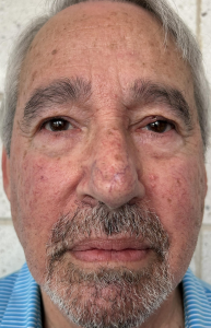 Steven L Friedman a registered Sex Offender of New York