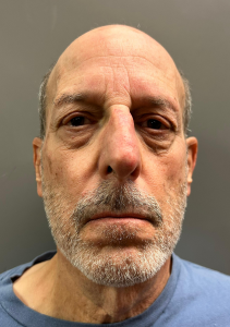 Jeffry D Zeitchick a registered Sex Offender of New York