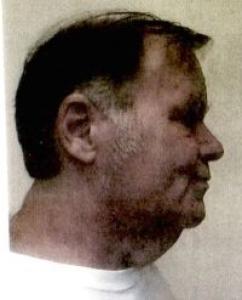 Lonny Patrick Ritzo a registered Sex Offender of North Dakota