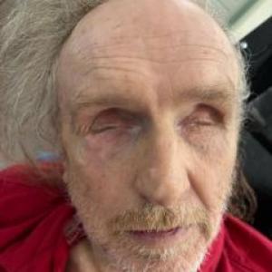 Harold William South a registered Sex Offender of Missouri