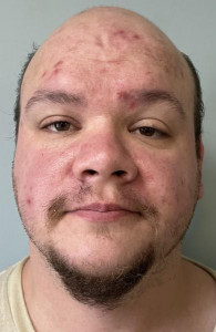 Joshua Thompson a registered Sex Offender of Vermont